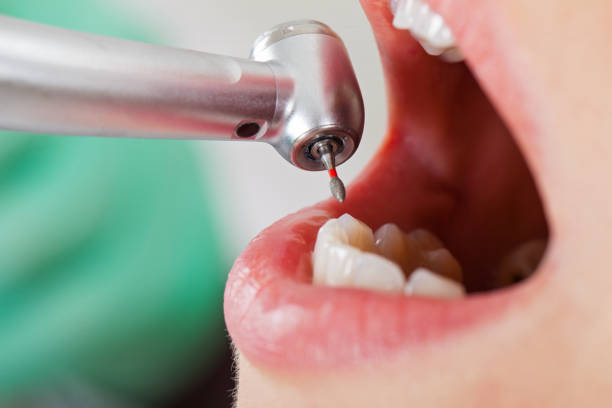 Best Urgent Dental Care for Toothaches in Estancia, NM